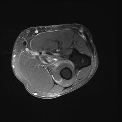 Click on the Serie image to view the images of Wieszt, Gnter